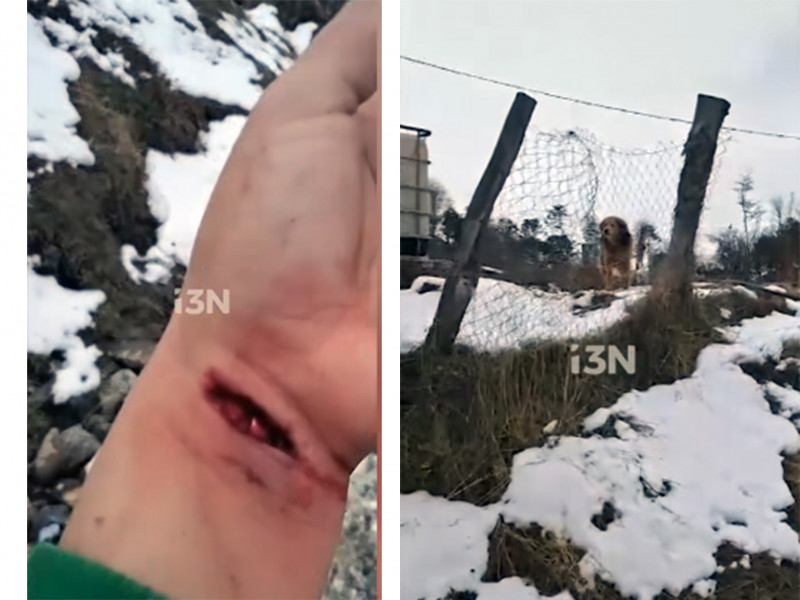 Mujer herida al ser atacada por un perro en Ushuaia